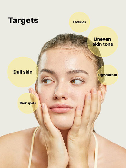 Woman with text labels on her face targeting freckles, uneven skin tone, pigmentation, dark spots, and dull skin.