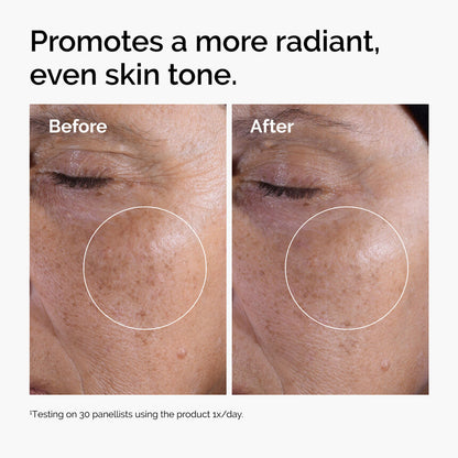 Before and after comparison of skin texture with text promoting a more radiant, even skin tone.