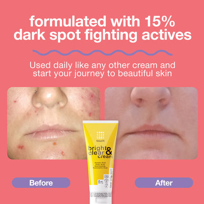 The image features an ad for Touch Bright & Clear Cream with a Before and After photo showing skin improvement, highlighting effective hyperpigmentation treatment. Text reads: formulated with 15% dark spot fighting actives, with a yellow tube of the cream displayed below.
