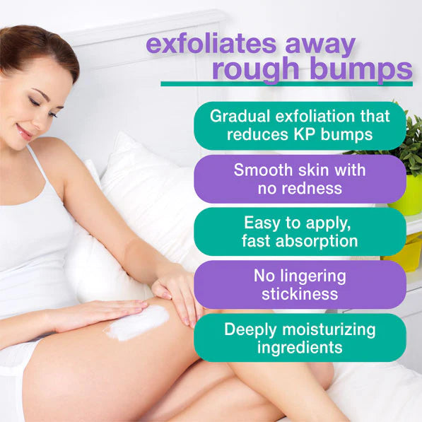 A woman applies Touch KP Exfoliating Lotion to her leg, sitting comfortably on a bed. The text highlights the lotion’s benefits: gradual exfoliation to reduce KP bumps, smooth skin without redness, fast absorption, no sticky residue, and deep moisturizing properties.