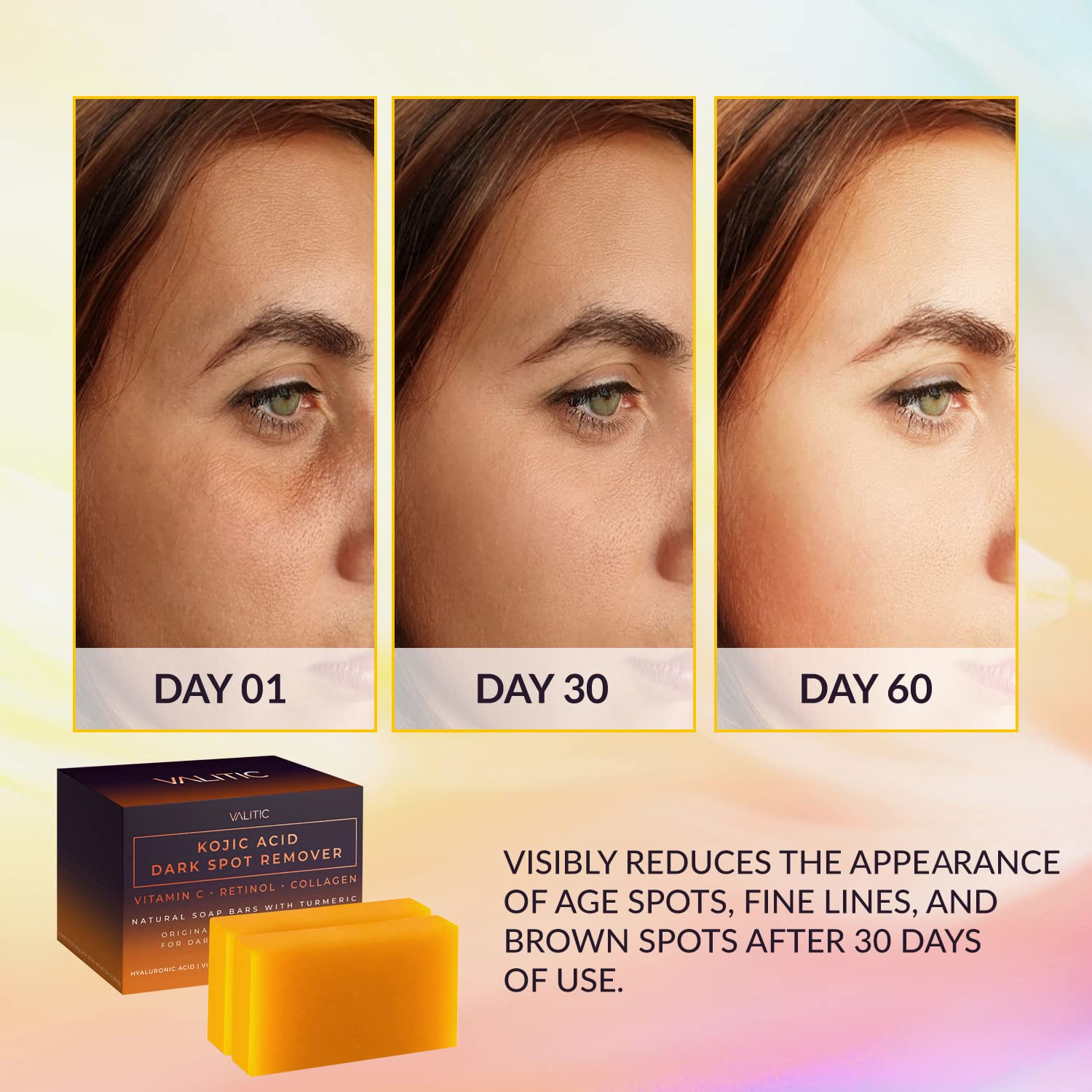 A three-panel comparison shows a womans face on day 1, 30, and 60, with fewer age spots and lines. Below is a VALITIC Kojic Acid Dark Spot Remover Soap with Retinol & Turmeric box and bar, highlighting visible skin-brightening in just 30 days.