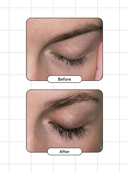 Before and after comparison of an eyebrow treatment on a grid background