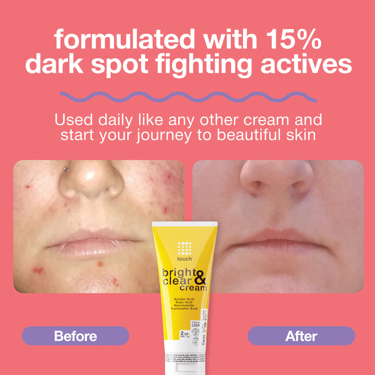 The image features an ad for Touch Bright & Clear Cream with a Before and After photo showing skin improvement, highlighting effective hyperpigmentation treatment. Text reads: formulated with 15% dark spot fighting actives, with a yellow tube of the cream displayed below.
